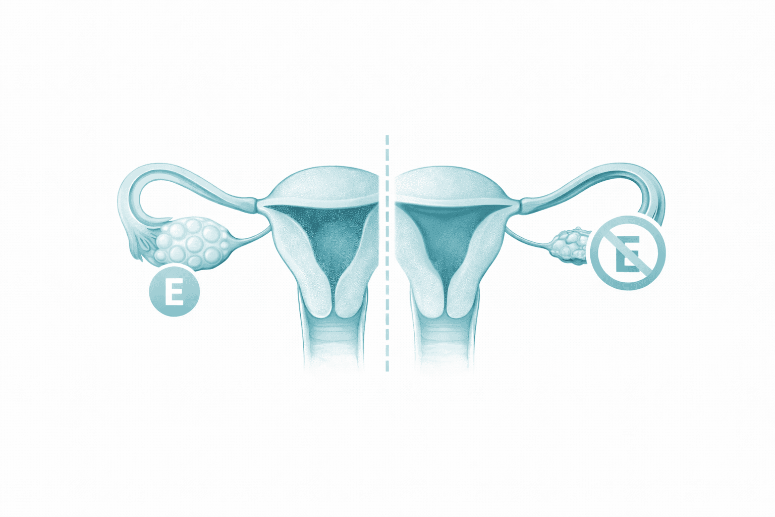 Illustration comparing normal ovarian estrogen activity with lower estrogen state in primary ovarian insufficiency.